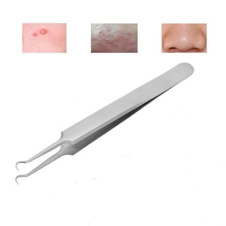 blackhead tweezers