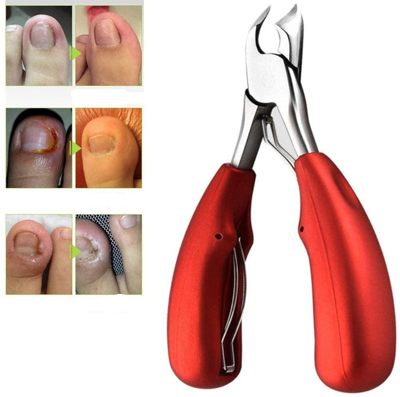 nail clippers for ingrown feet